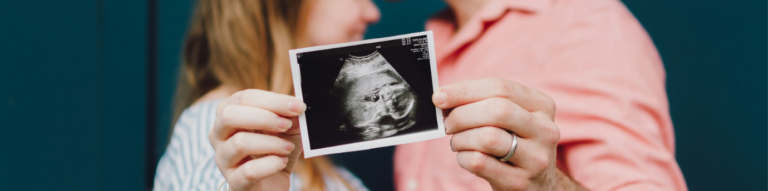 Two people holding a sonogram of a fetus